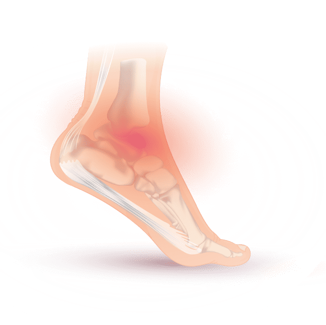 subtalar joint pain